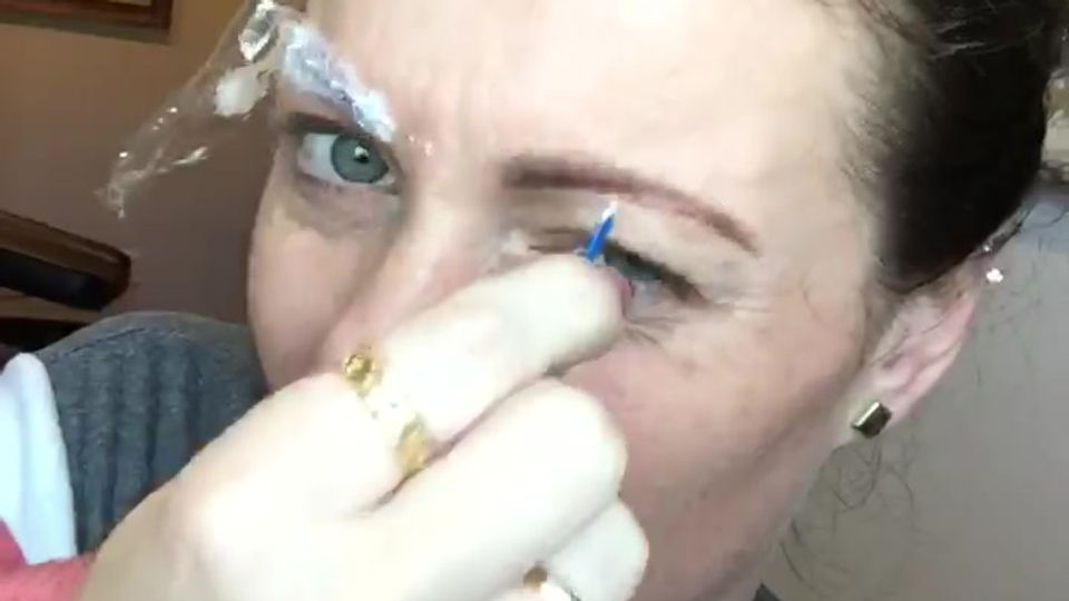 NUMBING TEST